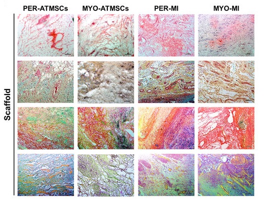 Desarrollan dos nuevas matrices de ingeniería tisular para la regeneración de tejido cardíaco post-infarto