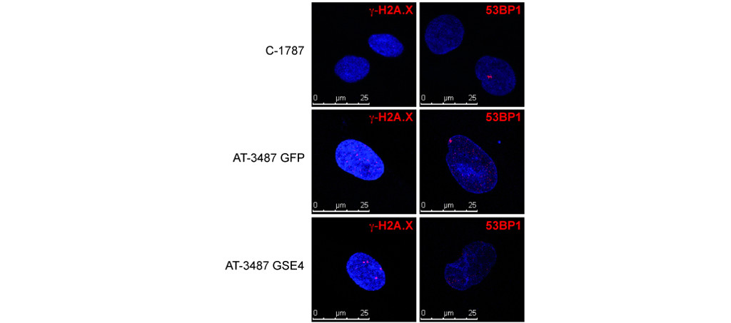 Un pequeño péptido atenúa los principales efectos patológicos en células de pacientes de ataxia telangiectasia
