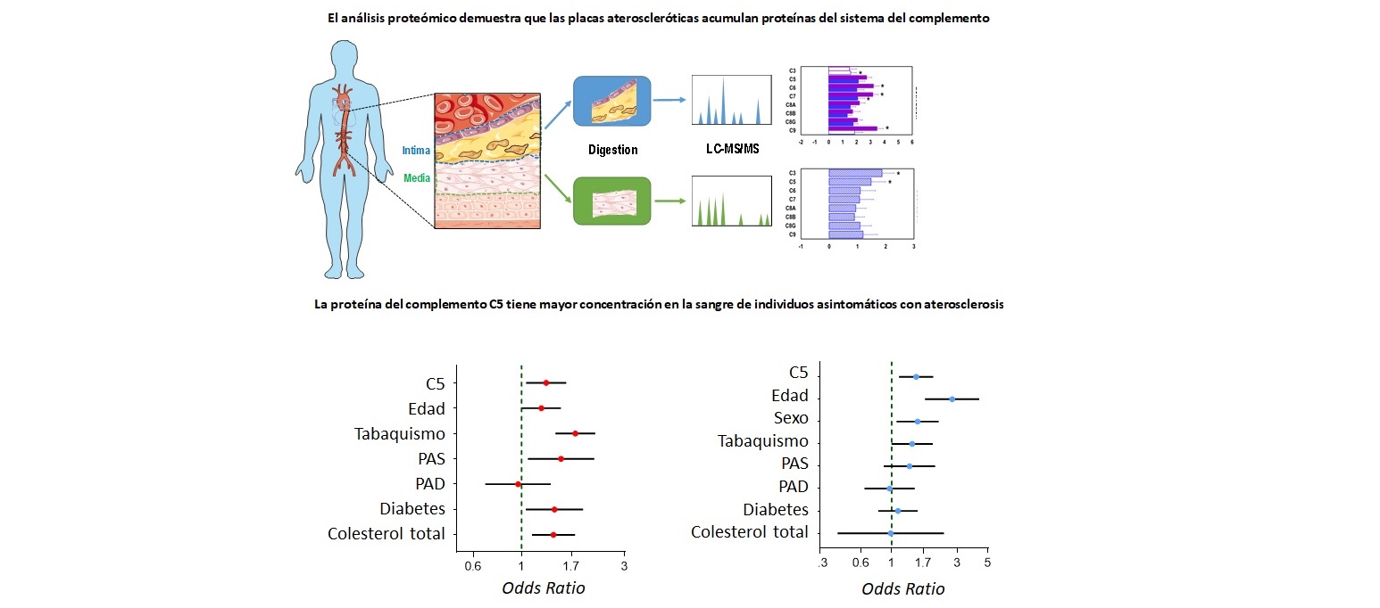 Identifican un biomarcador que detecta la existencia de aterosclerosis antes de tener síntomas