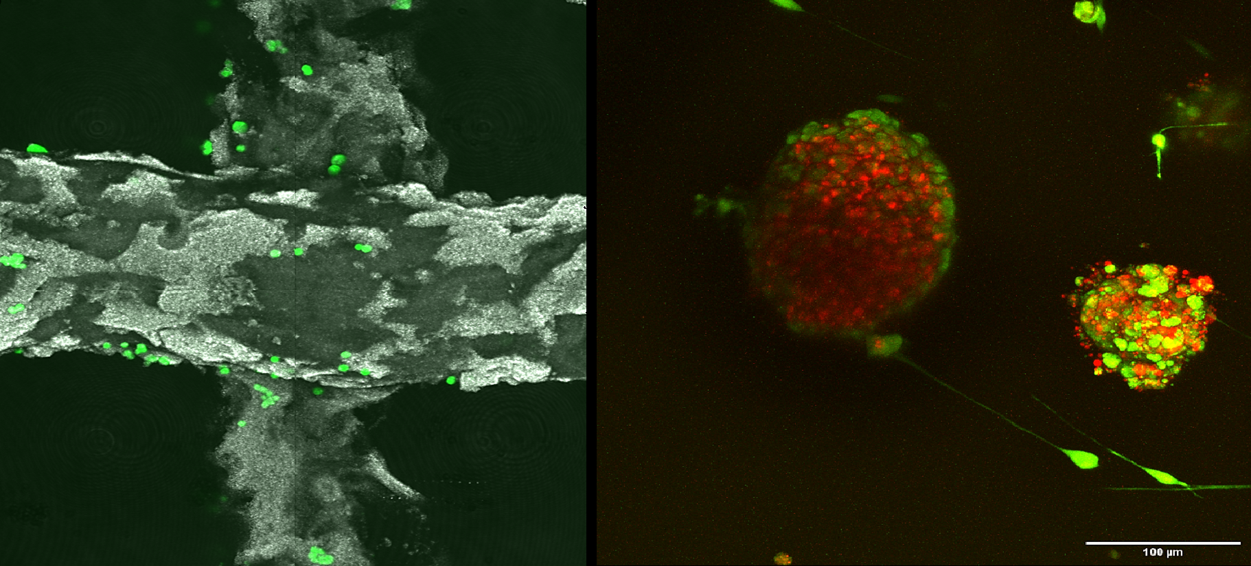 Exploran las entrañas de tumores cultivados en andamios tridimensionales inteligentes