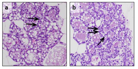 Describen el papel del gen ERAS en la generación de tumores mamarios y de otros epitelios