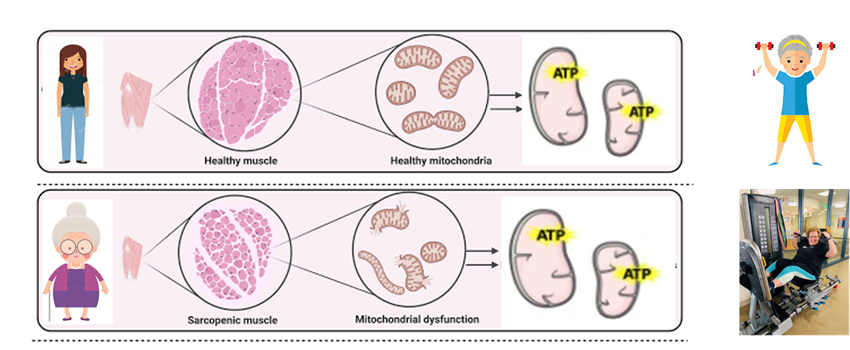 Día mundial de la actividad física: analizan la importancia del ejercicio de fuerza muscular para prevenir la fragilidad en las personas mayores y favorecer un envejecimiento saludable