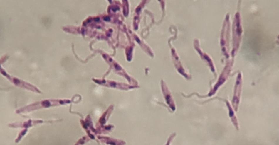 Una revisión sobre una familia de proteínas en los parásitos que causan la leishmaniasis podría facilitar la búsqueda de nuevos tratamientos