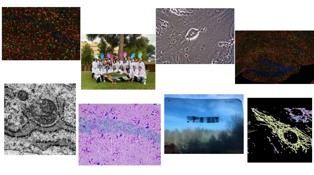 Abierta la votación del público del 3º Concurso CIBERER de fotografía sobre investigación en enfermedades raras