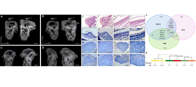 La deficiencia en IGF-1 altera los niveles de expresión de microRNAs y afecta a la incorporación postnatal de neuronas vestibulares