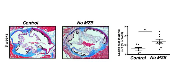 Descubren un papel protector ‘inesperado’ de un subtipo de células del sistema inmune frente a la aterosclerosis