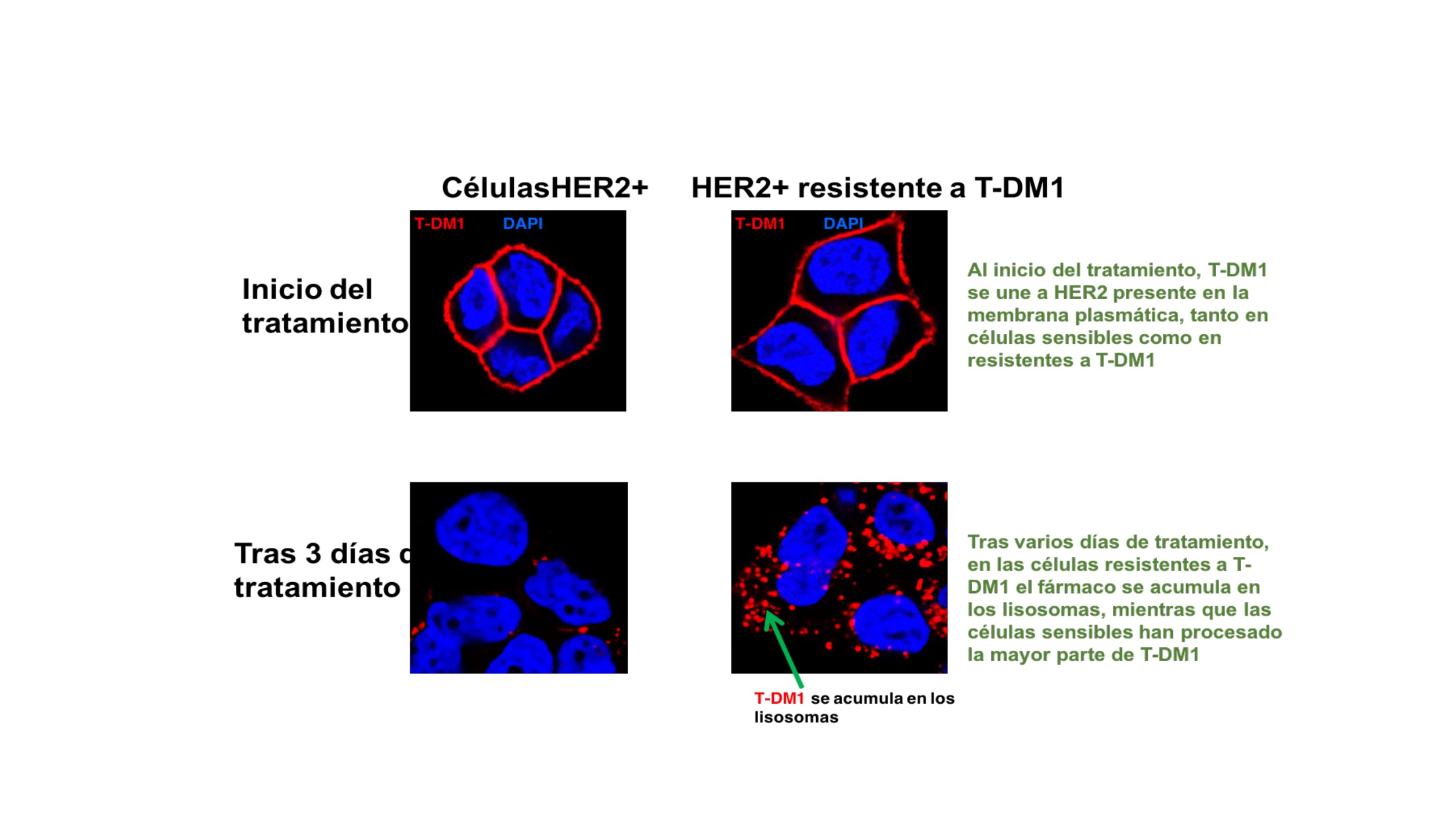 Describen un mecanismo de resistencia al fármaco contra el cáncer de mama trastuzumab-emtansina